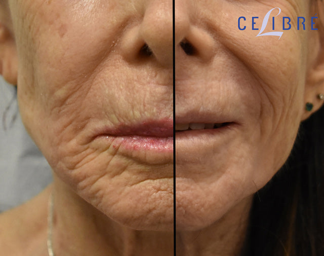 Multi Light Mask-Anti-aging LED Light Settings