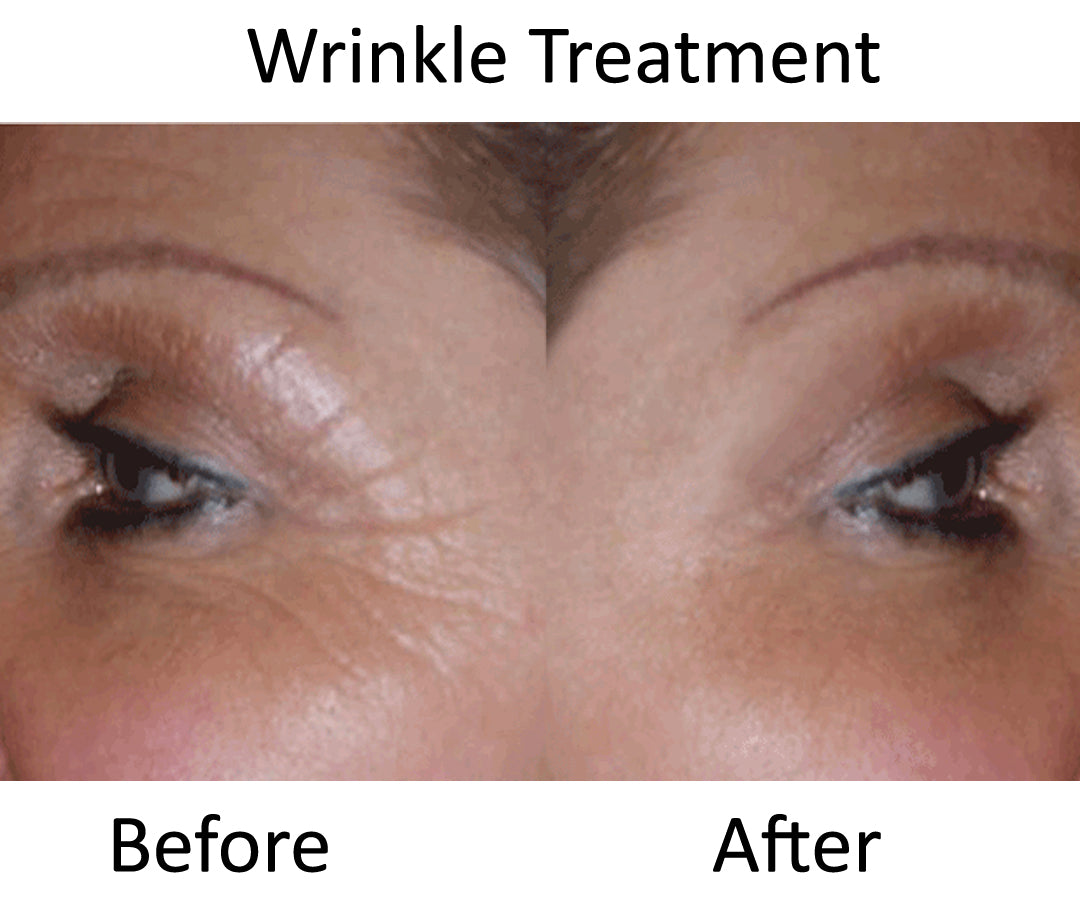 Revitalize Cream with Collagen & Retinoid
