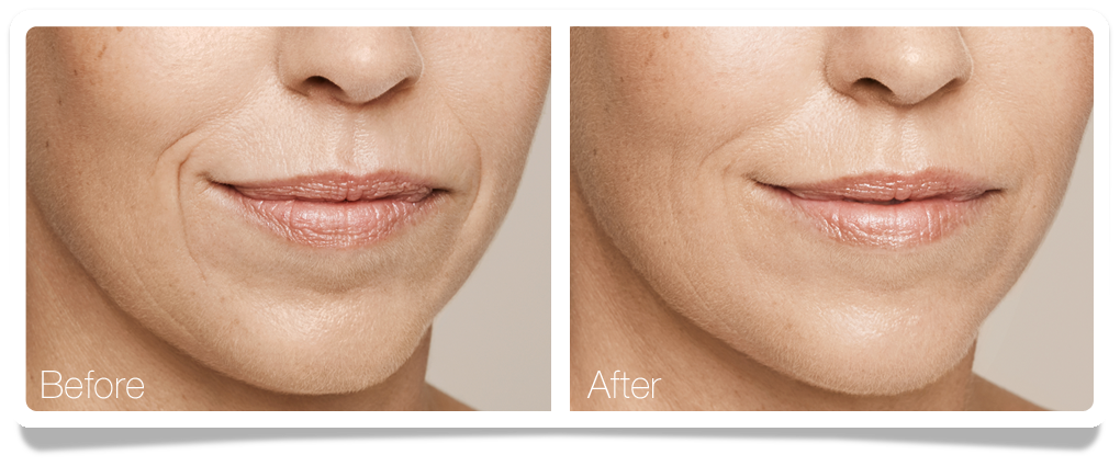 Revitalize Cream with Collagen & Retinoid